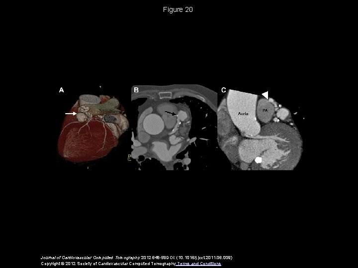 Figure 20 Journal of Cardiovascular Computed Tomography 2012 648 -59 DOI: (10. 1016/j. jcct.