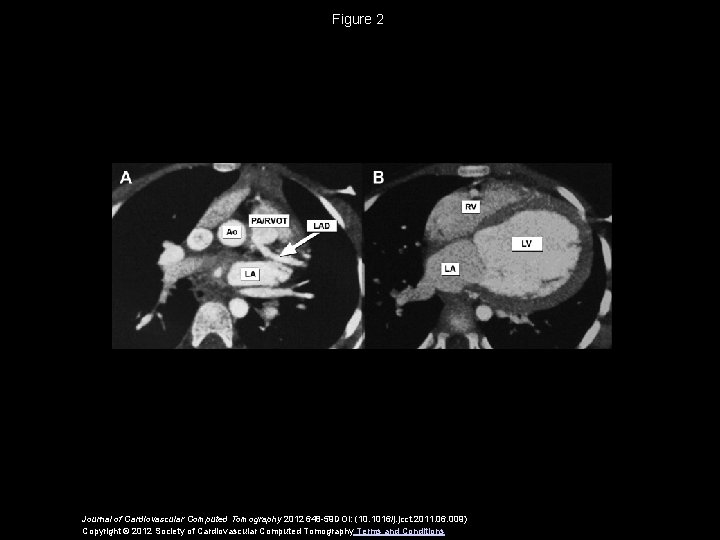 Figure 2 Journal of Cardiovascular Computed Tomography 2012 648 -59 DOI: (10. 1016/j. jcct.