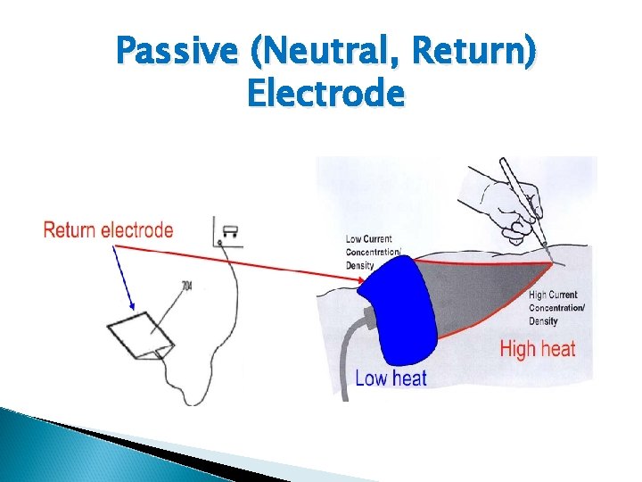 Passive (Neutral, Return) Electrode 