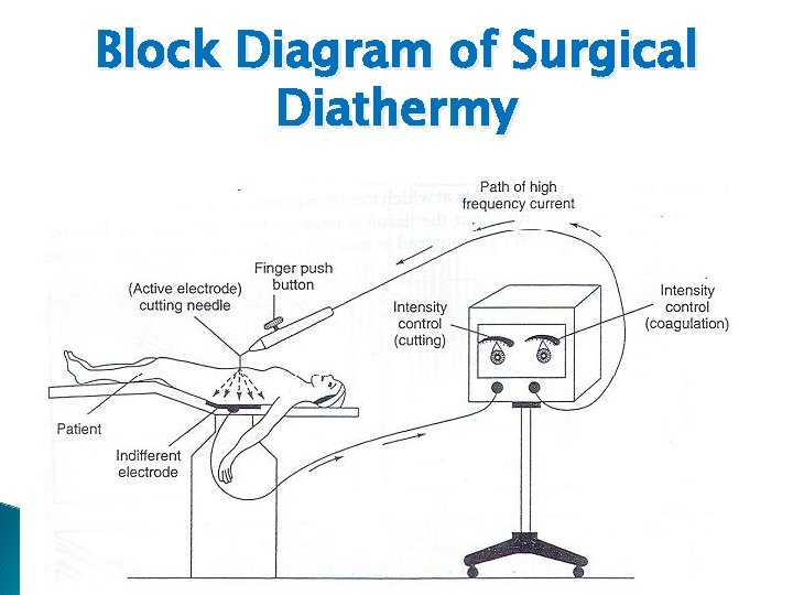 Block Diagram of Surgical Diathermy 