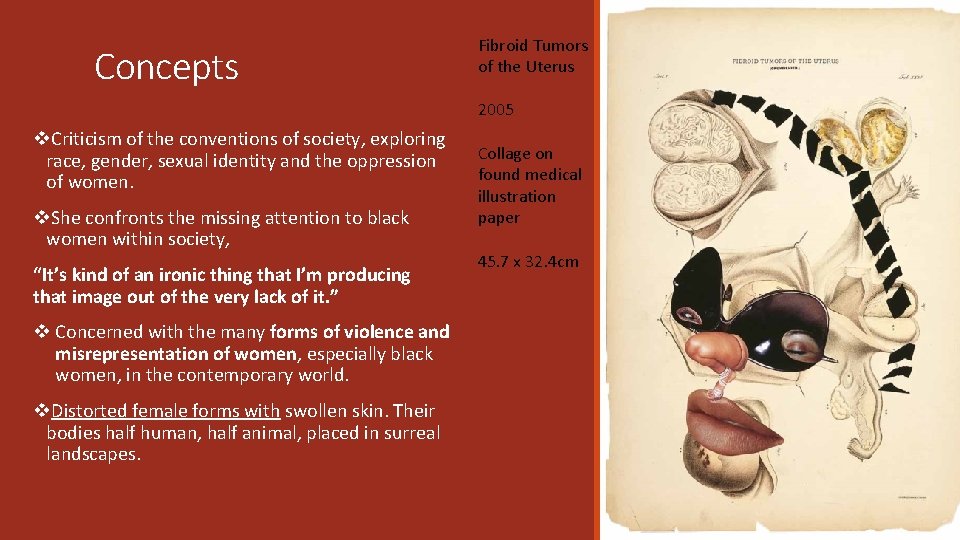 Concepts Fibroid Tumors of the Uterus 2005 v. Criticism of the conventions of society,