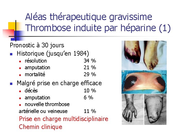 Aléas thérapeutique gravissime Thrombose induite par héparine (1) Pronostic à 30 jours n Historique