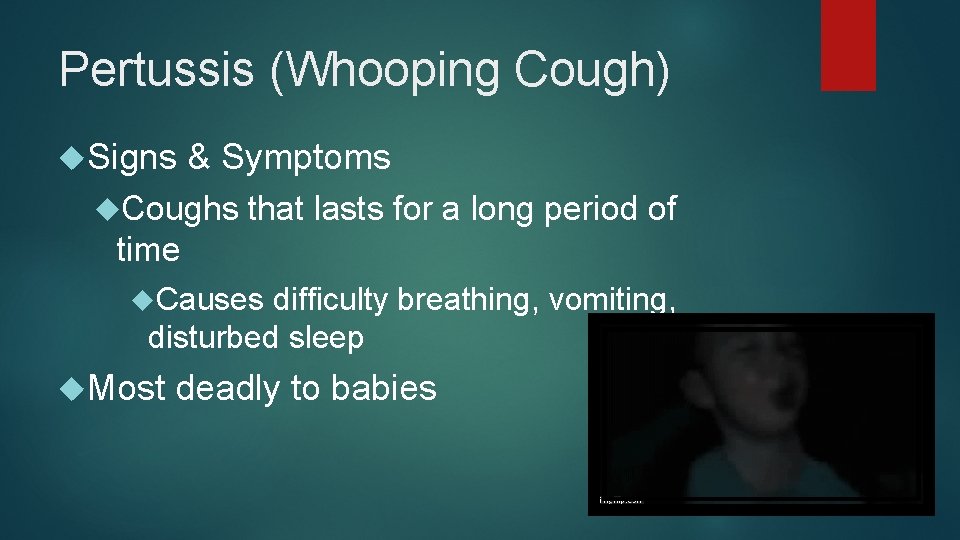 Pertussis (Whooping Cough) Signs & Symptoms Coughs that lasts for a long period of