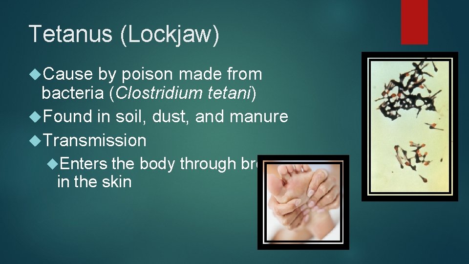 Tetanus (Lockjaw) Cause by poison made from bacteria (Clostridium tetani) Found in soil, dust,