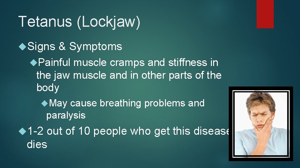 Tetanus (Lockjaw) Signs & Symptoms Painful muscle cramps and stiffness in the jaw muscle