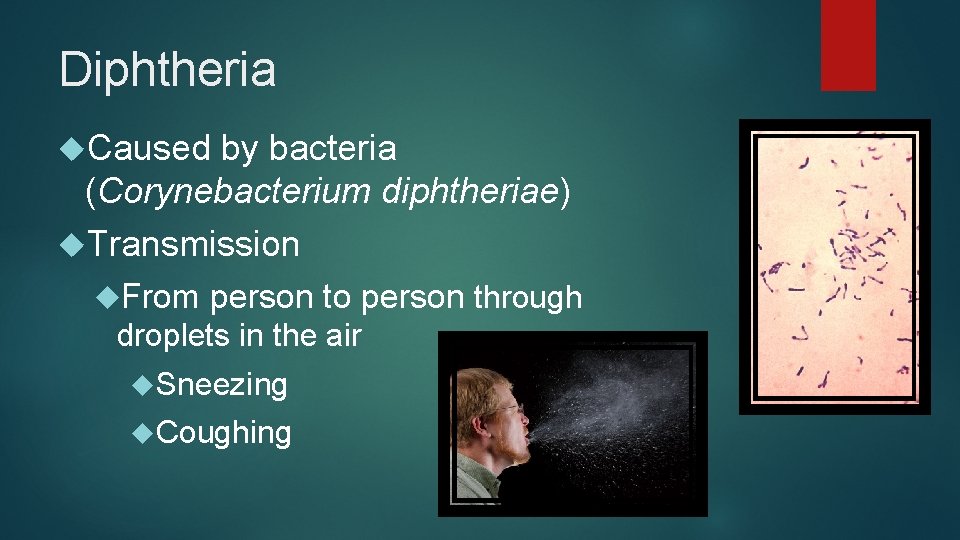 Diphtheria Caused by bacteria (Corynebacterium diphtheriae) Transmission From person to person through droplets in