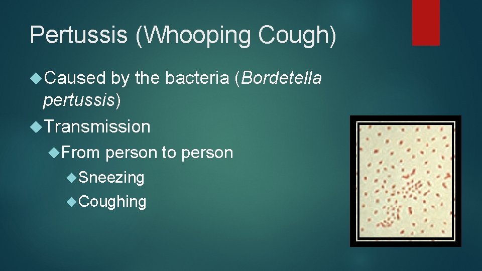Pertussis (Whooping Cough) Caused by the bacteria (Bordetella pertussis) Transmission From person to person