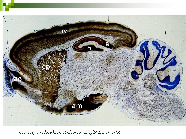 Courtesy Frederickson et al, Journal of Nutrition 2000 