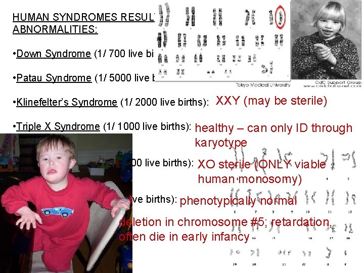 HUMAN SYNDROMES RESULTING FROM CHROMOSOMAL ABNORMALITIES: • Down Syndrome (1/ 700 live births): Trisomy