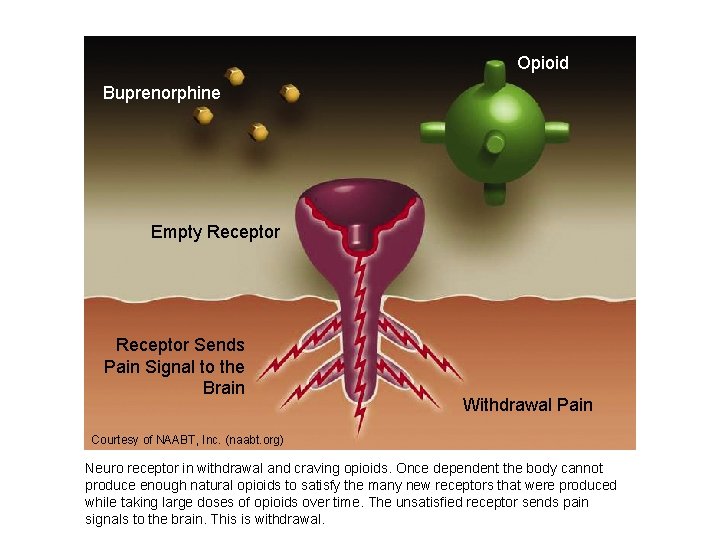 Opioid Buprenorphine Empty Receptor Sends Pain Signal to the Brain Withdrawal Pain Courtesy of