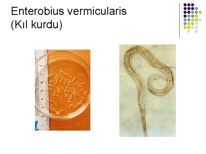 Enterobius vermicularis (Kıl kurdu) 