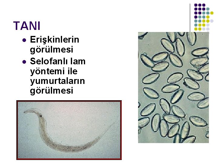 TANI l l Erişkinlerin görülmesi Selofanlı lam yöntemi ile yumurtaların görülmesi TANI l l Erişkinlerin görülmesi Selofanlı lam yöntemi ile yumurtaların görülmesi