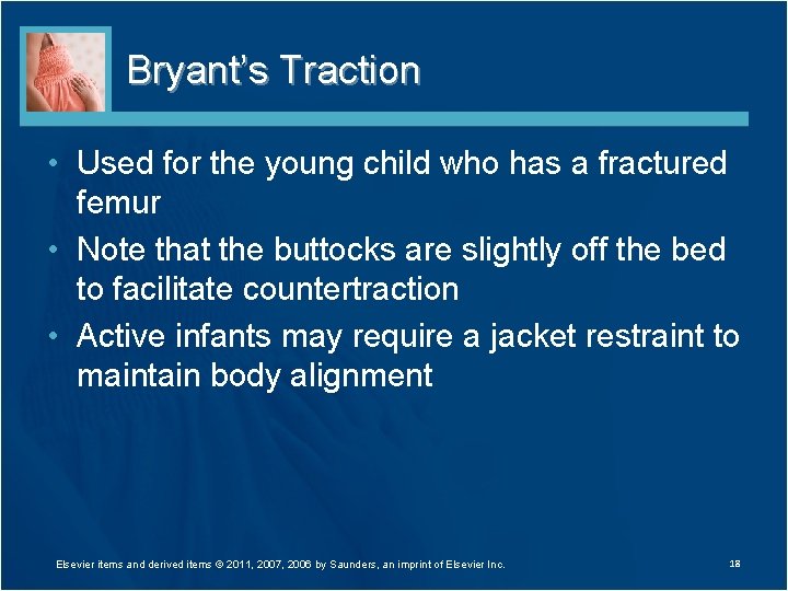 Bryant’s Traction • Used for the young child who has a fractured femur •