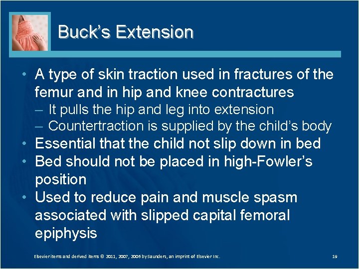 Buck’s Extension • A type of skin traction used in fractures of the femur