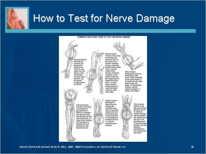 How to Test for Nerve Damage Elsevier items and derived items © 2011, 2007,