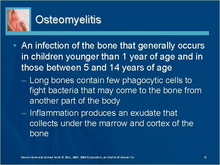Osteomyelitis • An infection of the bone that generally occurs in children younger than