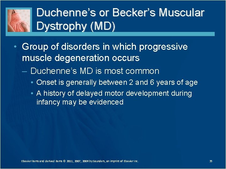 Duchenne’s or Becker’s Muscular Dystrophy (MD) • Group of disorders in which progressive muscle