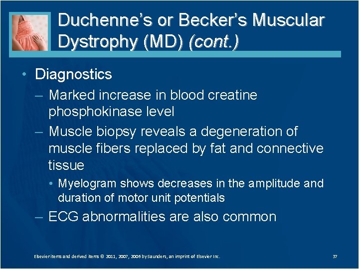 Duchenne’s or Becker’s Muscular Dystrophy (MD) (cont. ) • Diagnostics – Marked increase in