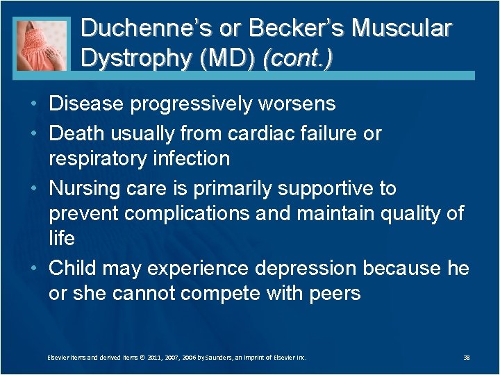 Duchenne’s or Becker’s Muscular Dystrophy (MD) (cont. ) • Disease progressively worsens • Death