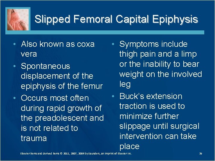 Slipped Femoral Capital Epiphysis • Also known as coxa • Symptoms include vera thigh