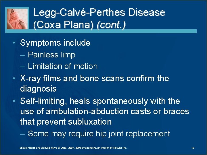 Legg-Calvé-Perthes Disease (Coxa Plana) (cont. ) • Symptoms include – Painless limp – Limitation