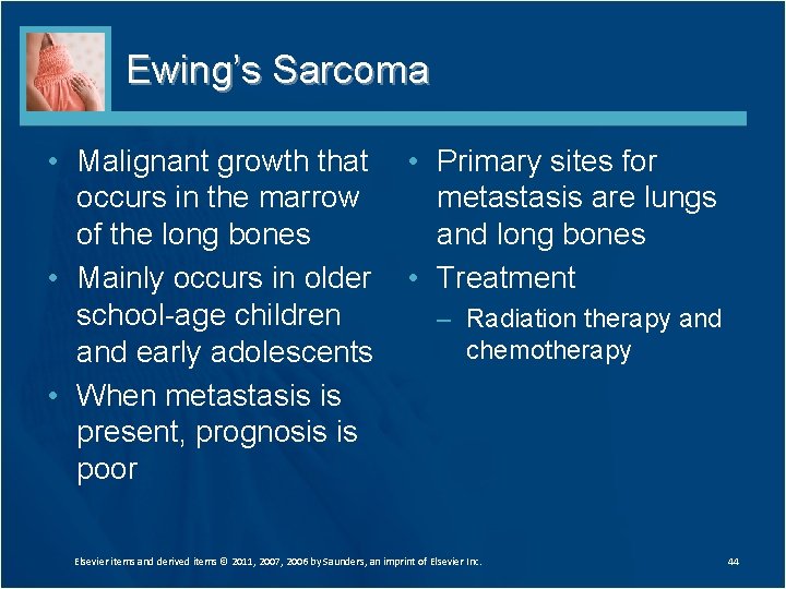 Ewing’s Sarcoma • Malignant growth that occurs in the marrow of the long bones