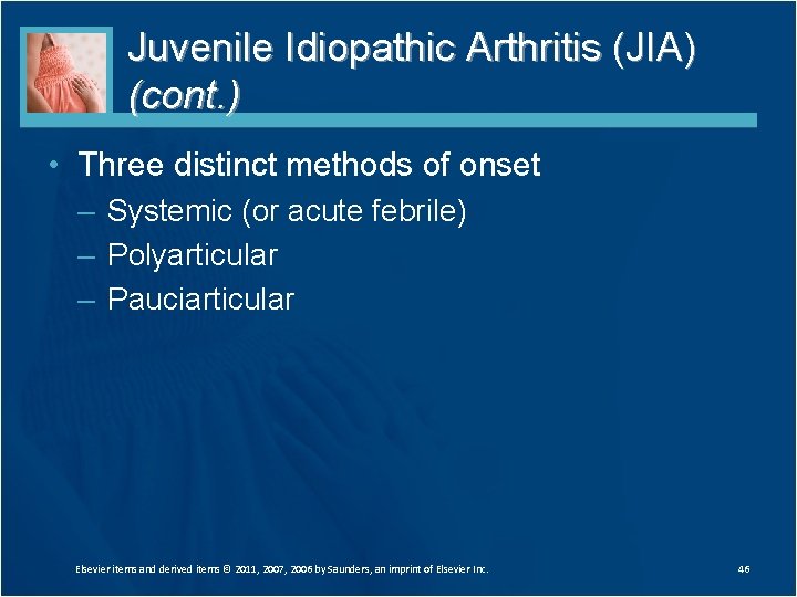 Juvenile Idiopathic Arthritis (JIA) (cont. ) • Three distinct methods of onset – Systemic