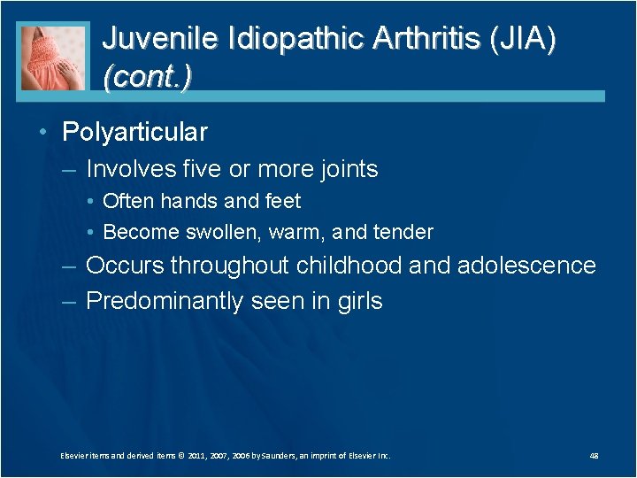 Juvenile Idiopathic Arthritis (JIA) (cont. ) • Polyarticular – Involves five or more joints