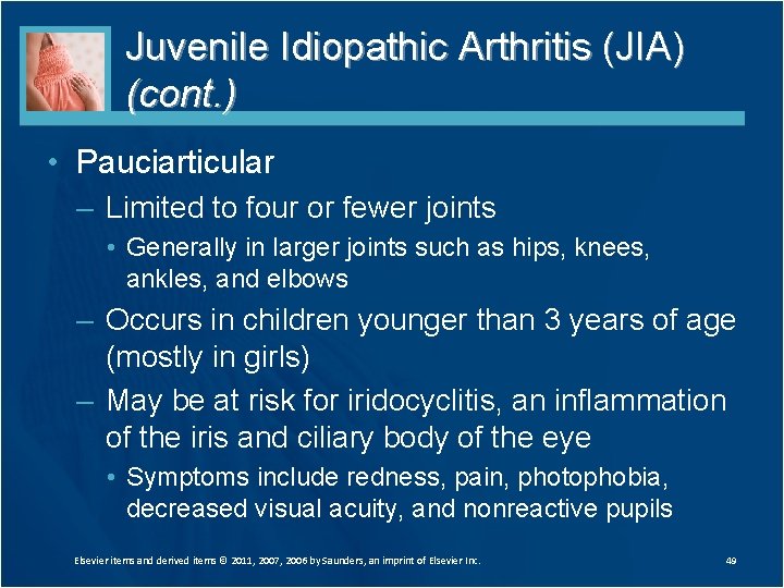 Juvenile Idiopathic Arthritis (JIA) (cont. ) • Pauciarticular – Limited to four or fewer