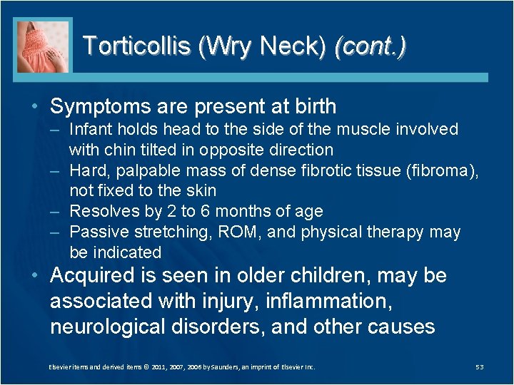 Torticollis (Wry Neck) (cont. ) • Symptoms are present at birth – Infant holds