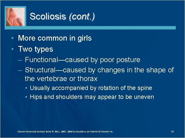 Scoliosis (cont. ) • More common in girls • Two types – Functional—caused by
