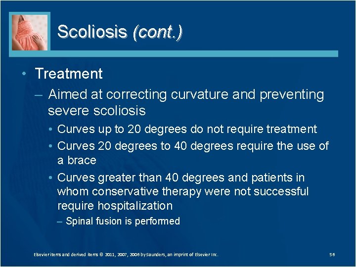 Scoliosis (cont. ) • Treatment – Aimed at correcting curvature and preventing severe scoliosis