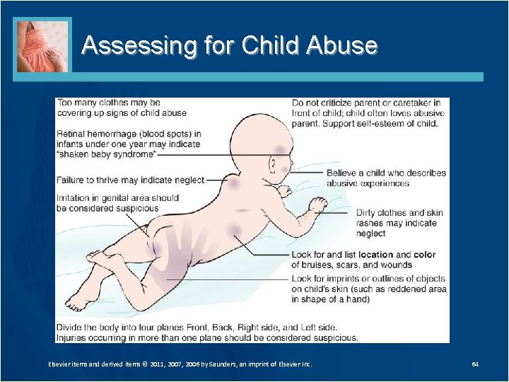 Assessing for Child Abuse Elsevier items and derived items © 2011, 2007, 2006 by