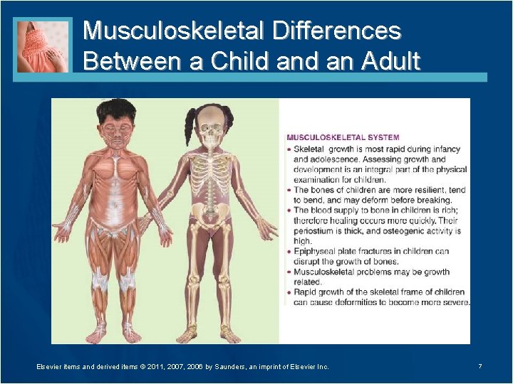 Musculoskeletal Differences Between a Child an Adult Elsevier items and derived items © 2011,