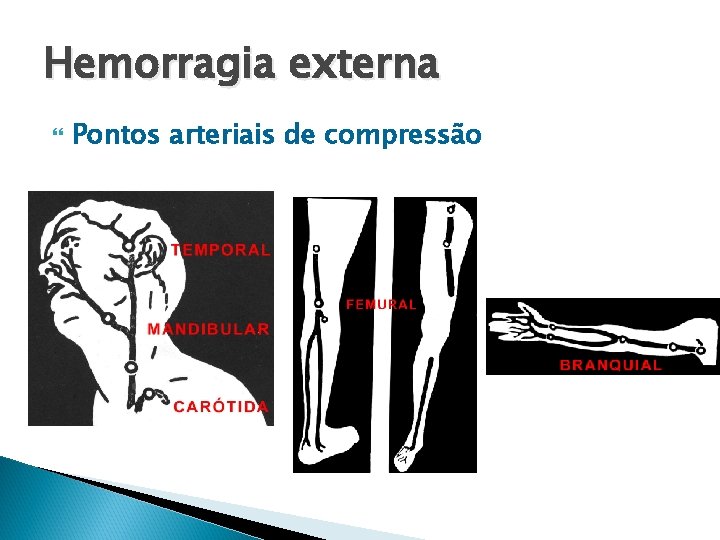 Hemorragia externa Pontos arteriais de compressão 