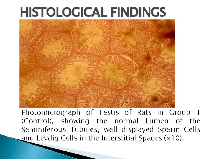 HISTOLOGICAL FINDINGS Photomicrograph of Testis of Rats in Group 1 (Control), showing the normal