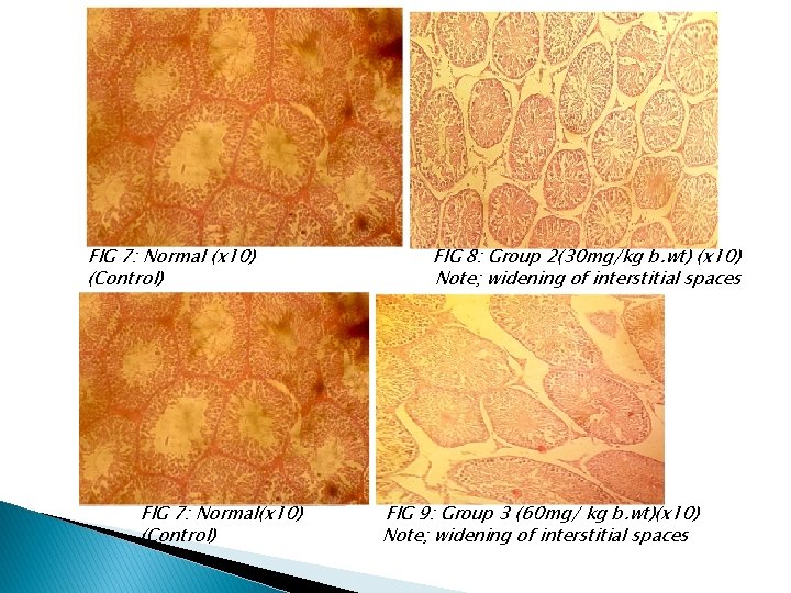 FIG 7: Normal (x 10) (Control) FIG 7: Normal(x 10) (Control) FIG 8: Group