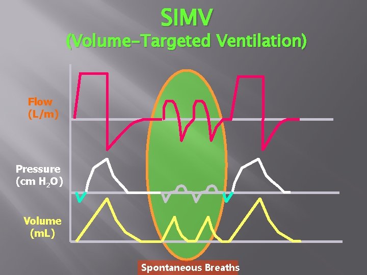 SIMV (Volume-Targeted Ventilation) Flow (L/m) Pressure (cm H 2 O) Volume (m. L) Spontaneous