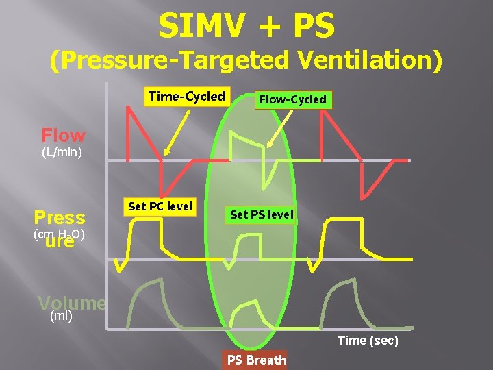 SIMV + PS (Pressure-Targeted Ventilation) Time-Cycled Flow (L/min) Press (cm H 2 O) ure