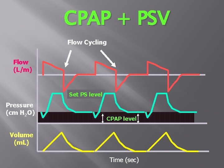 CPAP + PSV Flow Cycling Flow (L/m) Set PS level Pressure (cm H 2