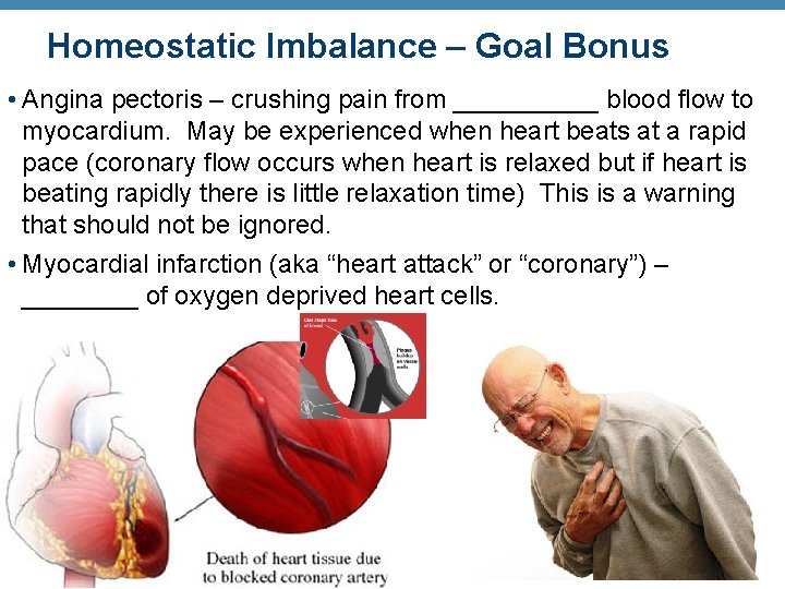 Homeostatic Imbalance – Goal Bonus • Angina pectoris – crushing pain from _____ blood