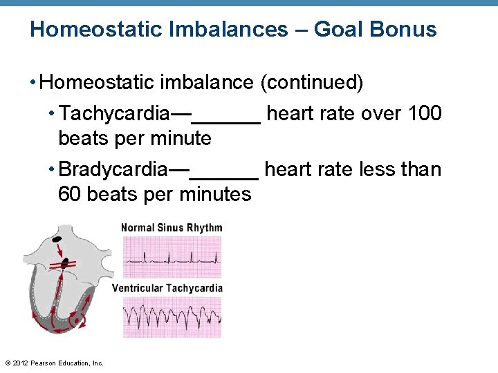 Homeostatic Imbalances – Goal Bonus • Homeostatic imbalance (continued) • Tachycardia—______ heart rate over