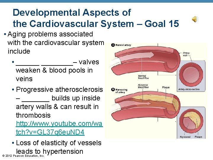 Developmental Aspects of the Cardiovascular System – Goal 15 • Aging problems associated with