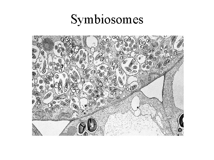 Symbiosomes 
