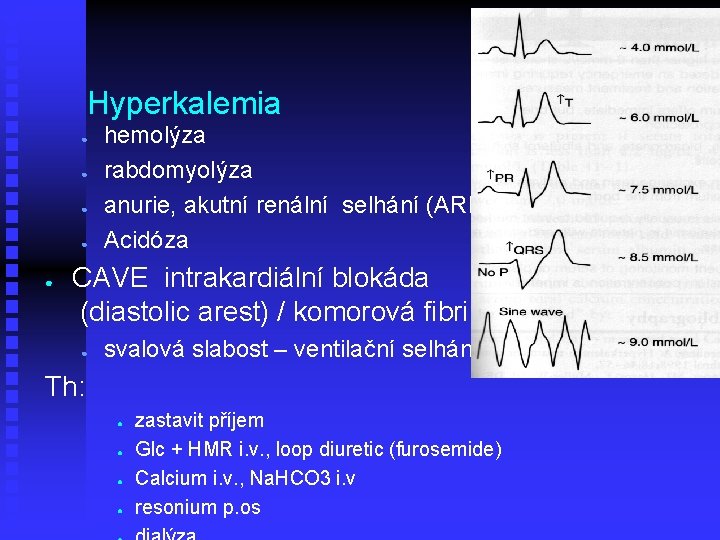 Hyperkalemia ● ● ● hemolýza rabdomyolýza anurie, akutní renální selhání (ARF) Acidóza CAVE intrakardiální