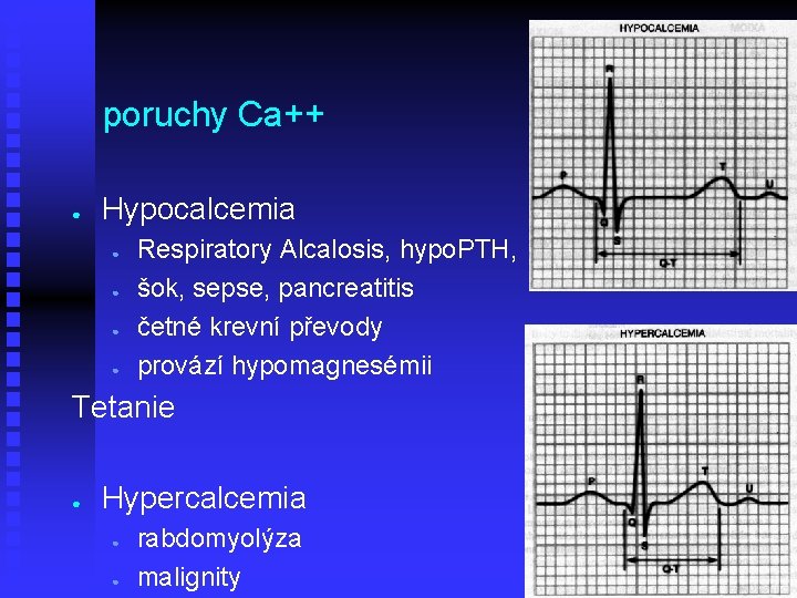 poruchy Ca++ ● Hypocalcemia ● ● Respiratory Alcalosis, hypo. PTH, šok, sepse, pancreatitis četné