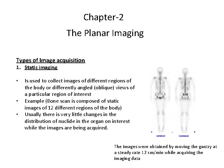 Chapter-2 The Planar Imaging Types of Image acquisition 1. Static imaging • • •