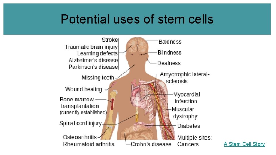 Potential uses of stem cells A Stem Cell Story 