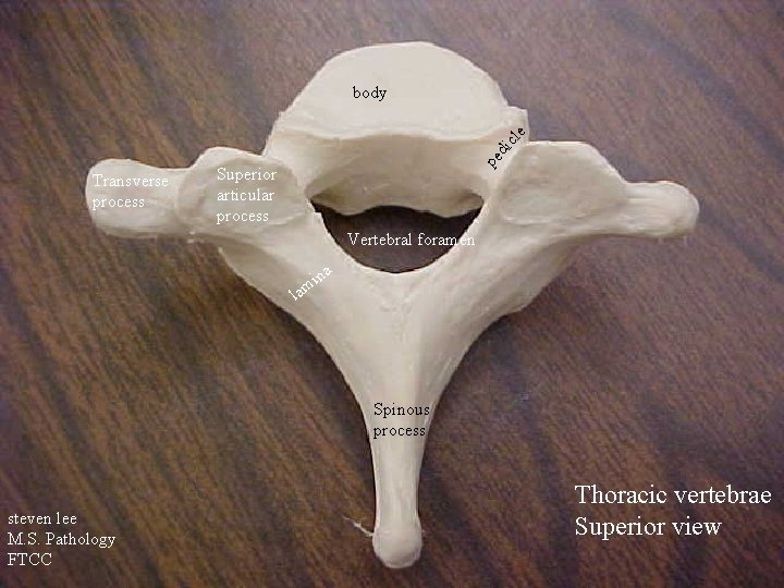 Transverse process pe di cle body Superior articular process Vertebral foramen na i m
