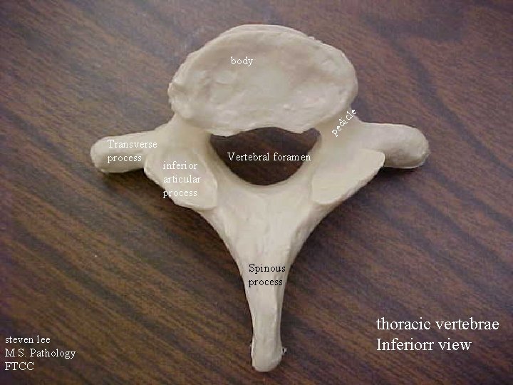 pe di cle body Transverse process inferior articular process Vertebral foramen Spinous process steven